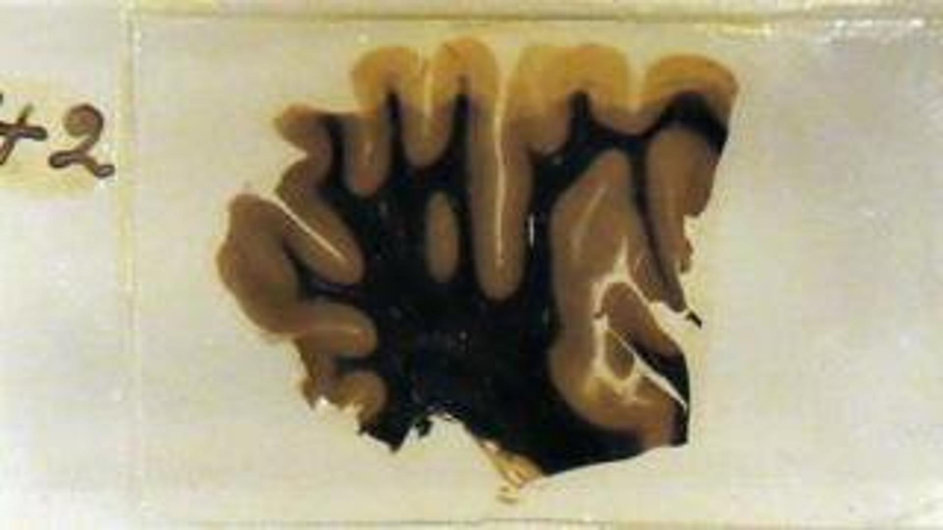 Londra, in mostra il cervello di Einstein - Il Secolo XIX