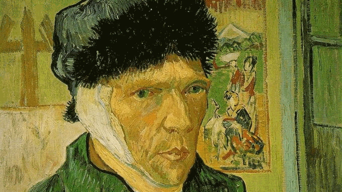 Van Gogh Risolto Il Giallo Dell orecchio La Stampa Van Gogh Risolto Il Giallo Dell orecchio La Stampa