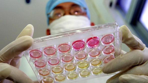 Gruppo Chiesi acquisisce KalVista: operazione da 1,9 miliardi di dollari sulle malattie rare