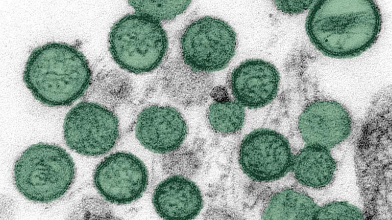 L’infettivologo: “Nessun rischio pandemia, ecco perché l’Hantavirus non è come il Covid”