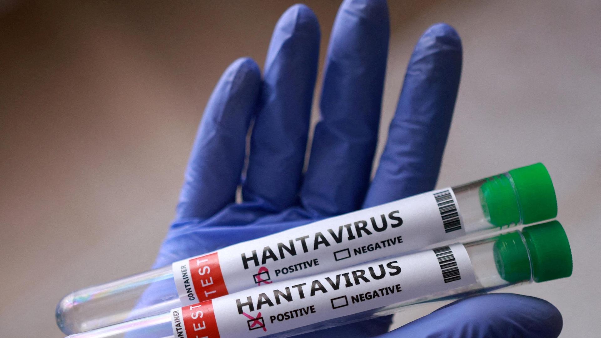 L&rsquo;Hantavirus in crociera e l&rsquo;inerzia nel gestire la crisi