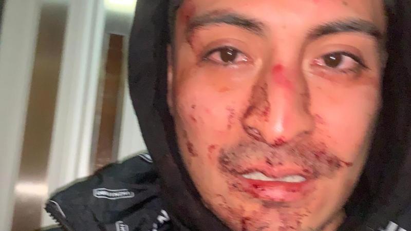 Mano nella mano a Capodanno, poi il pestaggio: tre imputati per l’aggressione a Stefano e Matteo