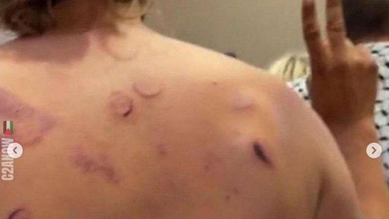 Le forze armate israeliane respingono le accuse: “Estranei ad abusi sugli attivisti della Flotilla”