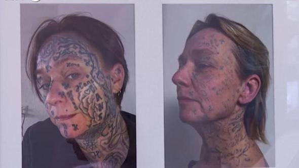 Tatuate a forza dai partner violenti, in Olanda il laser cancella i marchi degli abusi